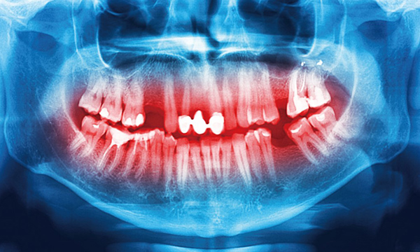periodontology